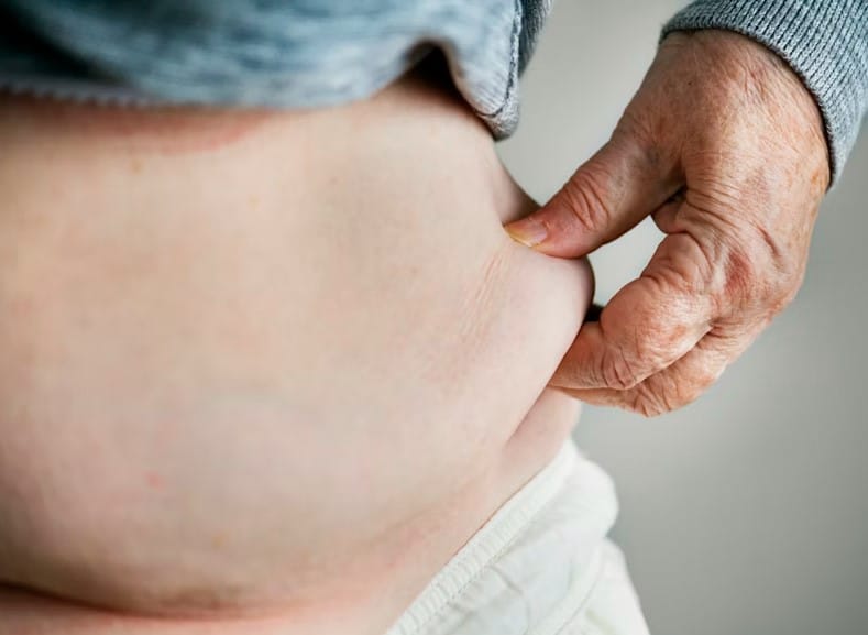 Abdominal Fat Loss Myths