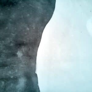 Photo Abdominal Fat Loss